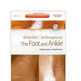 Arthritis and Arthroplasty The Foot and Ankle