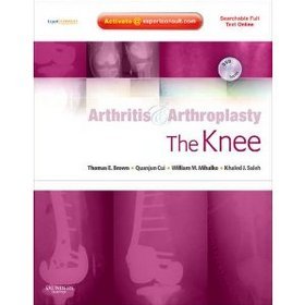 Arthritis and Arthroplasty The Knee
