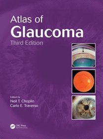 Atlas of Glaucoma