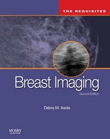 Breast Imaging 2e
