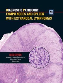Diagnostic Pathology Lymph Nodes and Spleen with Extranodal Lymphomas