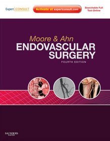 Endovascular Surgery 4e