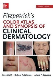 Fitzpatricks color atlas and synopsis of clinical dermatology