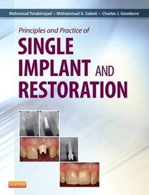 Principles and Practice of Single Implant and Restorations