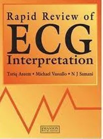 Rapid Review of Ecg Interpretation