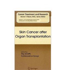 Skin Cancer after Organ Transplantation