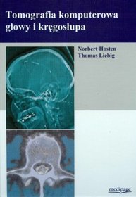 Tomografia komputerowa głowy i kręgosłupa