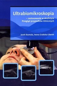 Ultrabiomikroskopia - zastosowanie w okulistyce. Przegląd przypadków klinicznych