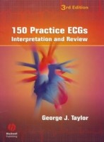 EBOOK 150 Practice ECGs