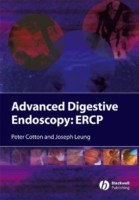 EBOOK Advanced Digestive Endoscopy