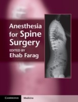 EBOOK Anesthesia for Spine Surgery