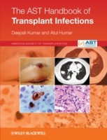 EBOOK AST Handbook of Transplant Infections