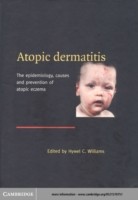 EBOOK Atopic Dermatitis