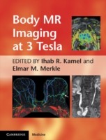 EBOOK Body MR Imaging at 3 Tesla