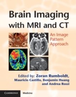 EBOOK Brain Imaging with MRI and CT