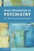 EBOOK Brain Stimulation in Psychiatry