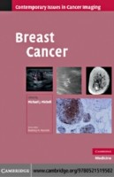 EBOOK Breast Cancer