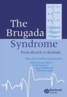 EBOOK Brugada Syndrome
