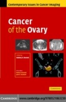 EBOOK Cancer of the Ovary