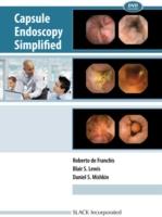 EBOOK Capsule Endoscopy Simplified