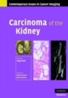 EBOOK Carcinoma of the Kidney