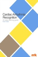 EBOOK Cardiac Arrhythmia Recognition