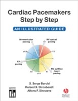 EBOOK Cardiac Pacemakers Step-by-Step