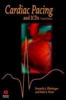 EBOOK Cardiac Pacing and ICDs