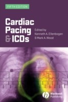 EBOOK Cardiac Pacing and ICDs