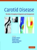 EBOOK Carotid Disease