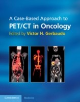 EBOOK Case-Based Approach to PET/CT in Oncology