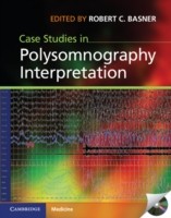 EBOOK Case Studies in Polysomnography Interpretation