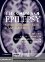 EBOOK Causes of Epilepsy