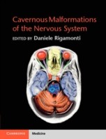 EBOOK Cavernous Malformations of the Nervous System