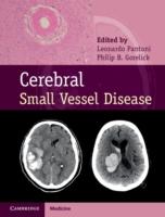 EBOOK Cerebral Small Vessel Disease