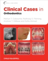 EBOOK Clinical Cases in Orthodontics