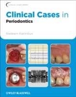 EBOOK Clinical Cases in Periodontics