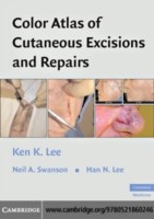 EBOOK Color Atlas of Cutaneous Excisions and Repairs