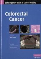 EBOOK Colorectal Cancer