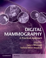 EBOOK Digital Mammography