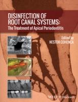 EBOOK Disinfection of Root Canal Systems