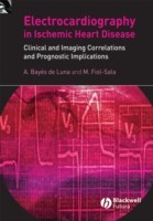 EBOOK Electrocardiography in Ischemic Heart Disease