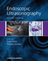 EBOOK Endoscopic Ultrasonography