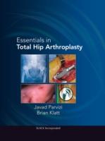 EBOOK Essentials in Total Hip Arthroplasty