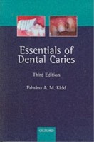 EBOOK Essentials of Dental Caries: The Disease and Its Management, 3rd ed.