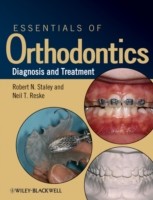 EBOOK Essentials of Orthodontics