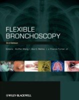 EBOOK Flexible Bronchoscopy