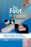 EBOOK Foot in Diabetes