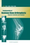 EBOOK Fundamentals of Revision Knee Arthroplasty