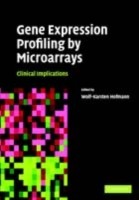 EBOOK Gene Expression Profiling by Microarrays